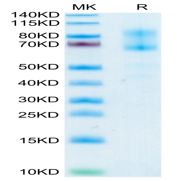 Human IL-2 R beta&IL-2 R gamma Protein (ILR-HM2BG)