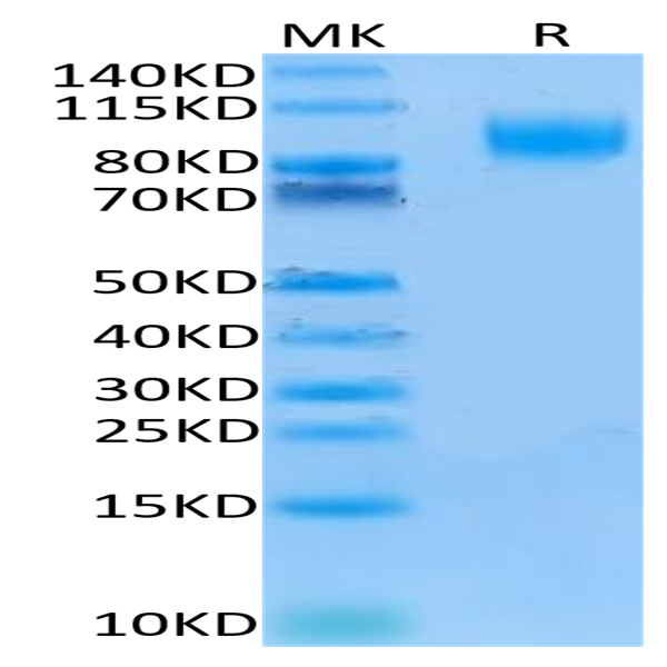 Human IL-13Ra1 Protein (ILR-HM2R1)