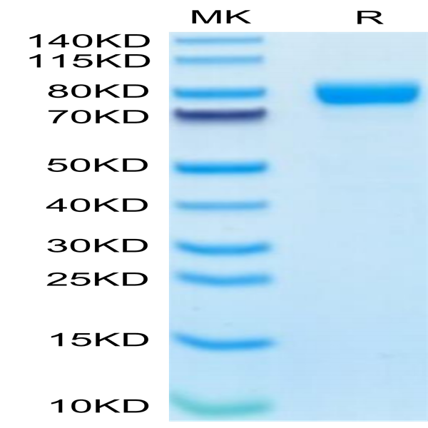 Human IL-1R3/IL-1 RAcP Protein (ILR-HM2R3)