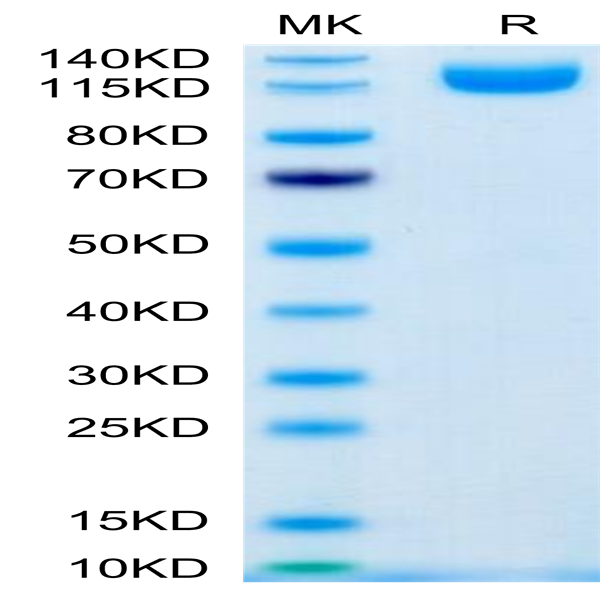 Human IL-31 RA Protein (ILR-HM2RA)