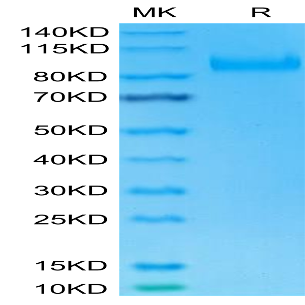 Human IL-23R Protein (ILR-HM323)