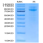 Human IL-27RA/TCCR Protein (ILR-HM427)