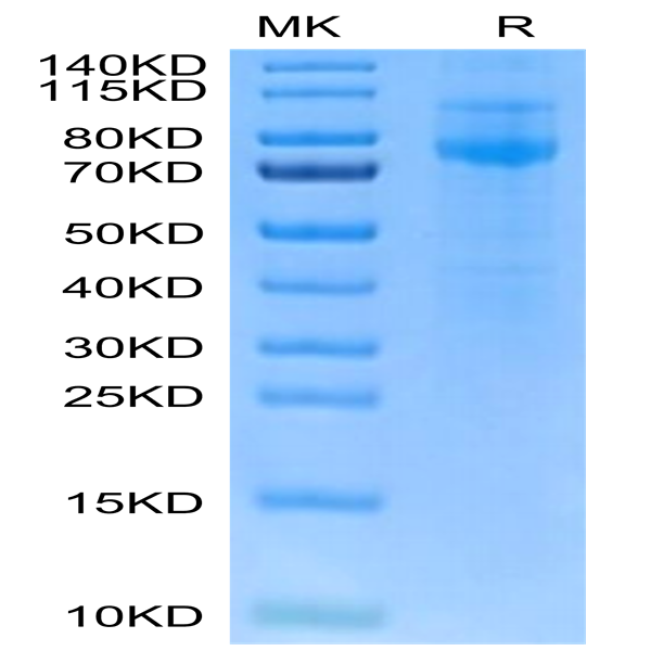 Human IL-27RA/TCCR Protein (ILR-HM427)