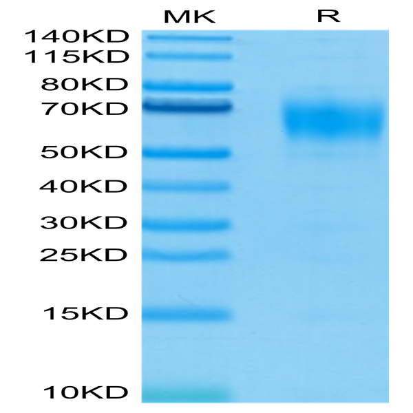 Biotinylated Human IL-13Ra1 Protein (ILR-HM4R1B)