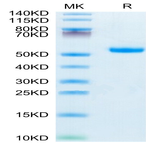 Mouse IL-5 R alpha/CD125 Protein (ILR-MM15R)