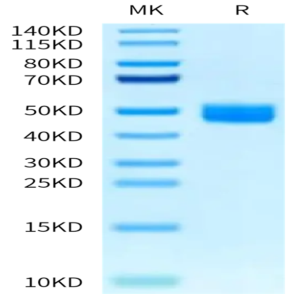 Mouse IL-13Ra2 Protein (ILR-MM1R2)