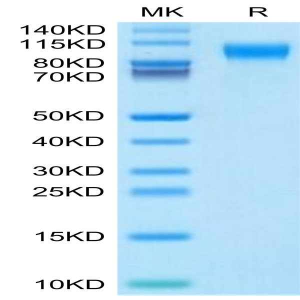 Mouse IL-31 RA Protein (ILR-MM1RA)