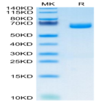 Mouse IL-22R alpha 1 Protein (ILR-MM222)