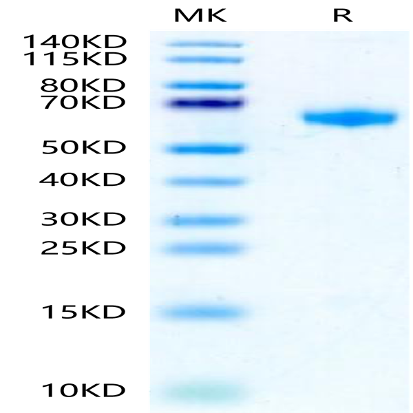 Rat IL-22R alpha 1 Protein (ILR-RM222)