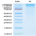 Human Integrin alpha 10 beta 1 (ITGA10&ITGB1) Heterodimer Protein BP003803 Syd Labs