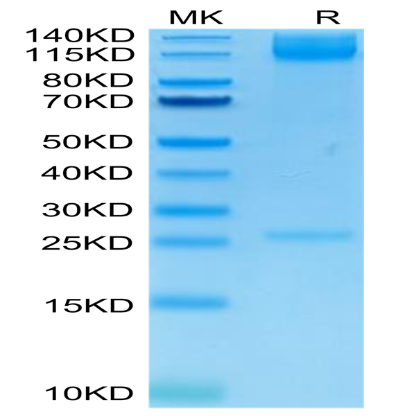 Human Integrin alpha 5 beta 1 (ITGA5&ITGB1) Heterodimer Protein (ITG-HM451)