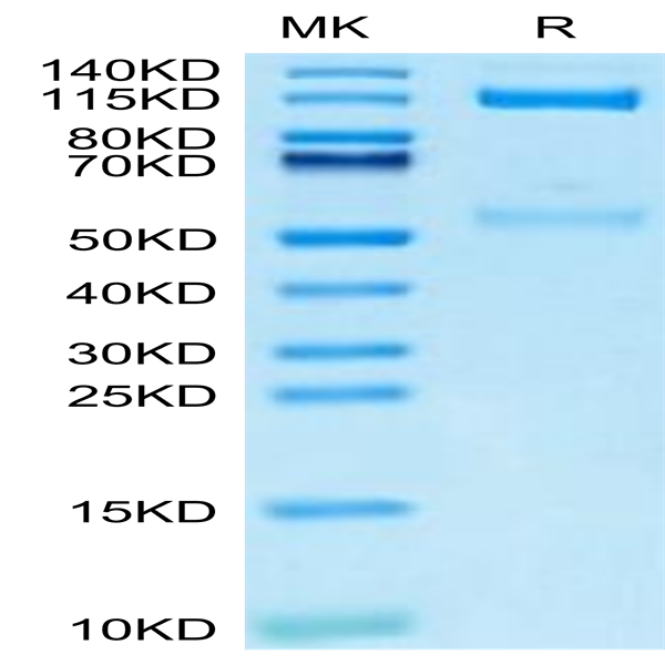 Mouse Integrin alpha V beta 3 (ITGAV&ITGB3) Heterodimer Protein (ITG-MM2V3)