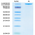 Human Jagged 1/JAG1 Protein BP003474 Syd Labs