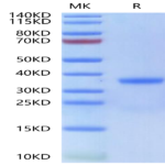 Human Kallikrein 3/PSA Protein (KLK-HM103)