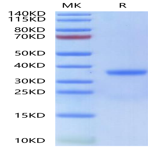 Human Kallikrein 3/PSA Protein (KLK-HM103)