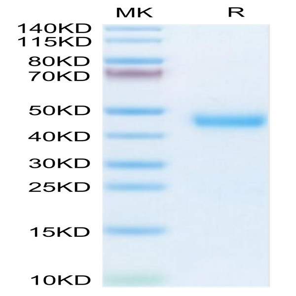 Mouse Kallikrein 5/KLK5 Protein (KLK-MM105)