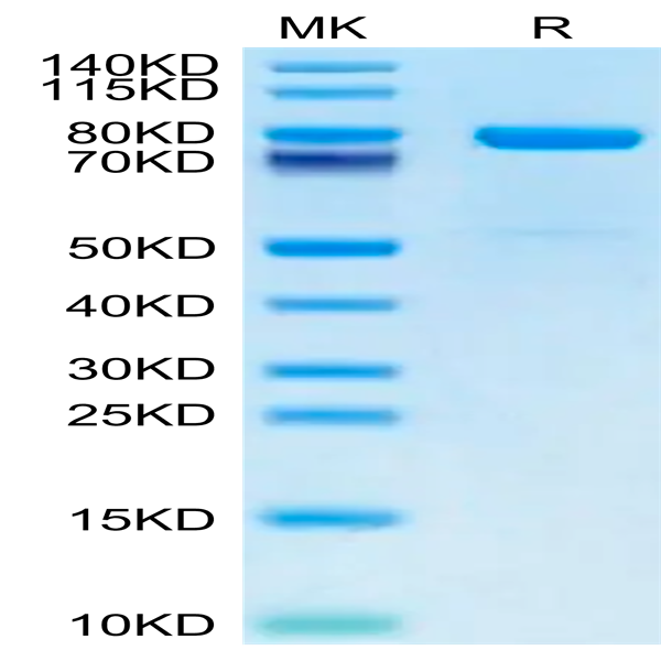 Mouse KLKB1 Protein (KLK-MM1B1)