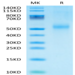 Mouse Kremen-2 Protein BP004736 Syd Labs