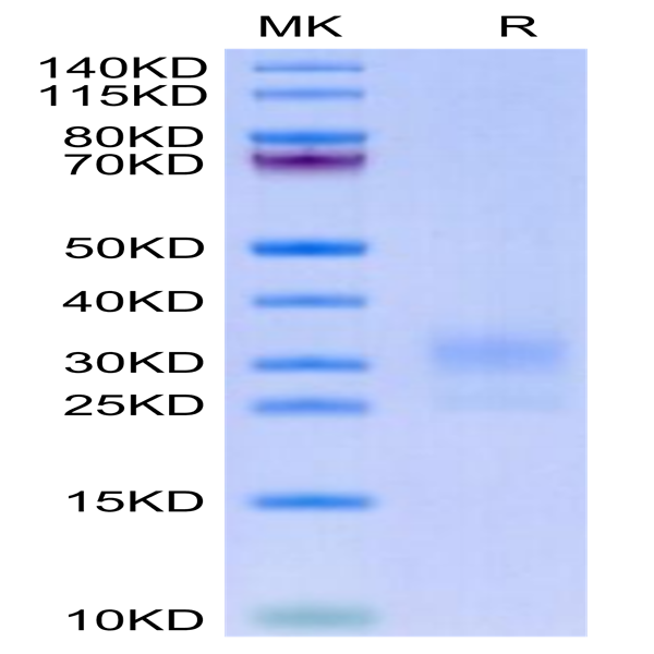 Biotinylated Human LAIR1/CD305 Protein (LAI-HM4R1B)