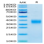 Mouse LAIR1/CD305 Protein (LAI-MM1R1)