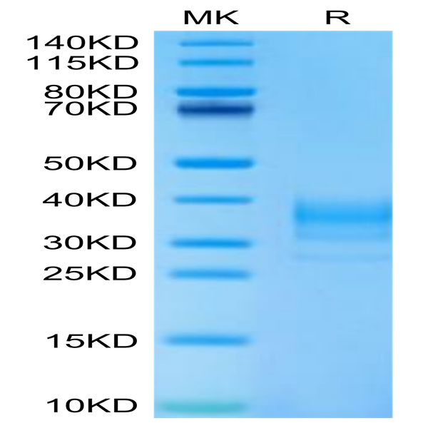 Human LAMP5 Protein (LAM-HM105)