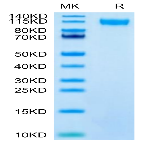 SARS-CoV-2 Spike S1 (Lambda C.37) Protein (LCS-VM1S1)