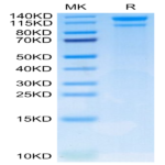 Human LDLR Protein (LDL-HM401)