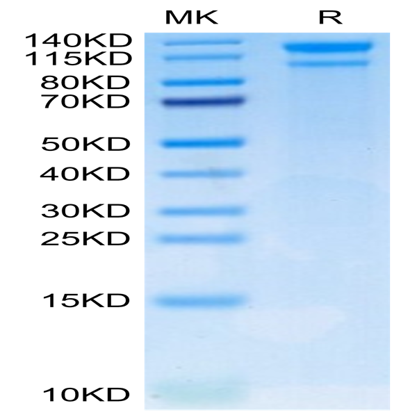 Human LDLR Protein (LDL-HM401)