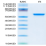 Human LGMN Protein BP004804 Syd Labs