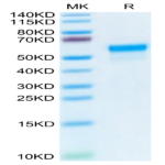 Mouse LGMN Protein (LGM-MM101)