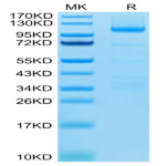 Human LGR-5 Protein (LGR-HM205)