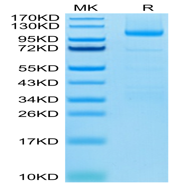 Human LGR-5 Protein (LGR-HM205)