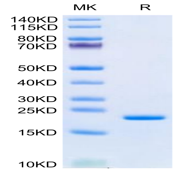 Human LIF Protein (LIF-HE001)