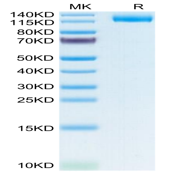 Human LIF R/CD118 Protein (LIF-HM10R)