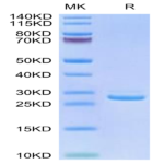 Human LILRB1/CD85j/ILT2 Domain1&2 Protein (LIL-HM11D)