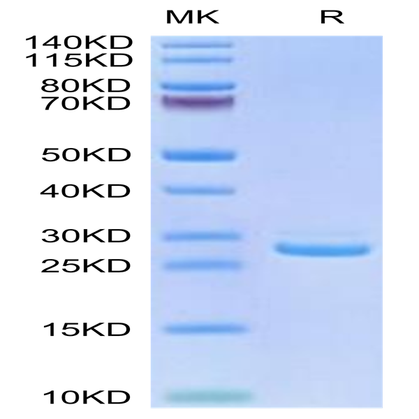 Human LILRB1/CD85j/ILT2 Domain1&2 Protein (LIL-HM11D)