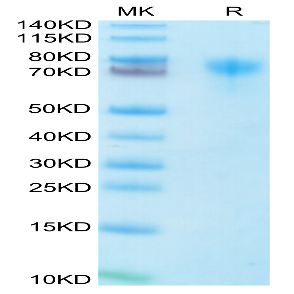 Human LILRA1/CD85i/LIR-6 Protein (LIL-HM4A1)