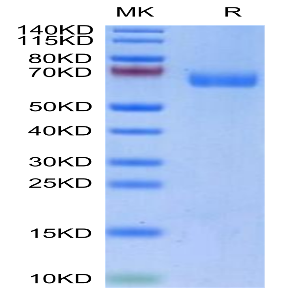 Biotinylated Human LILRA4/CD85g Protein (LIL-HM4A4B)