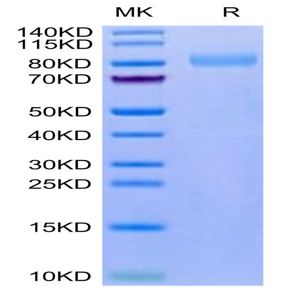 Mouse LRRN1 Protein (LNR-MM101)