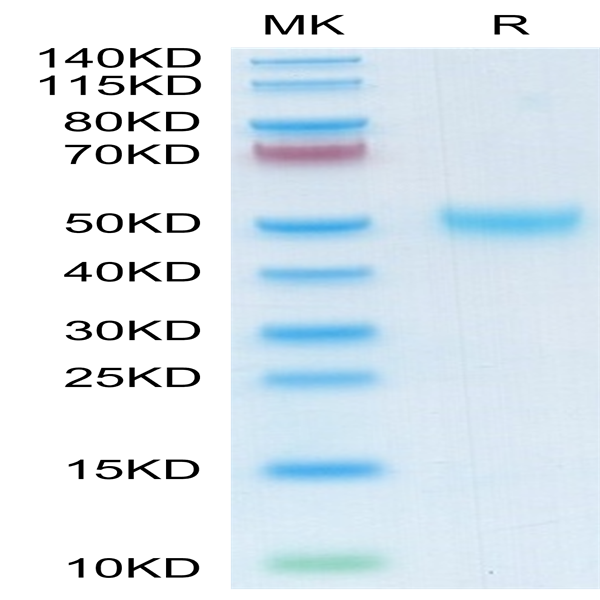 Mouse LRG1 Protein (LRG-MM101)