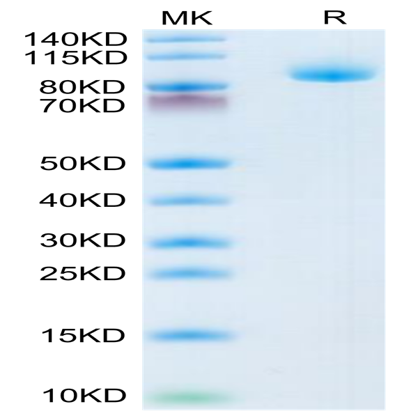 Human LRIG1 Protein (LRI-HM101)