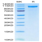 Human LRP-5 Protein (LRP-HM205)