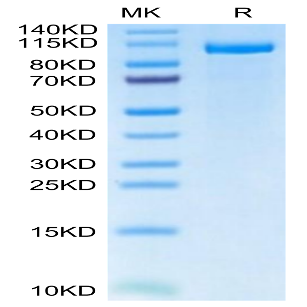 Human LRP-5 Protein (LRP-HM205)