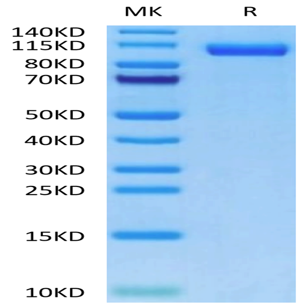 Human LRP-5 Protein (LRP-HM305)