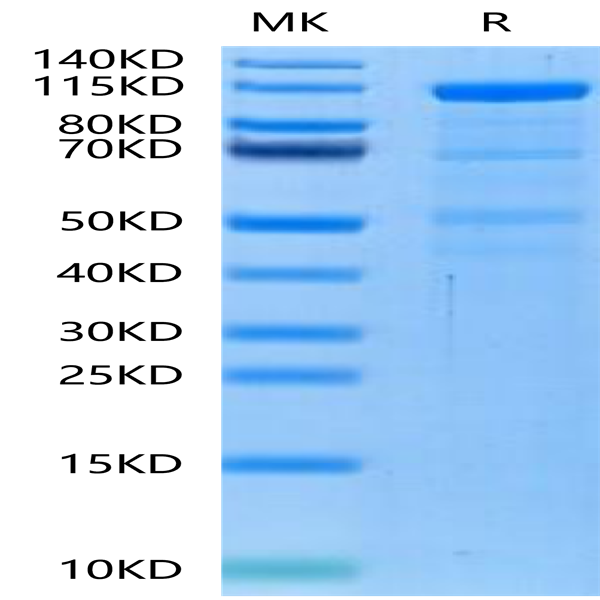 Human LRP-6 Protein (LRP-HM306)
