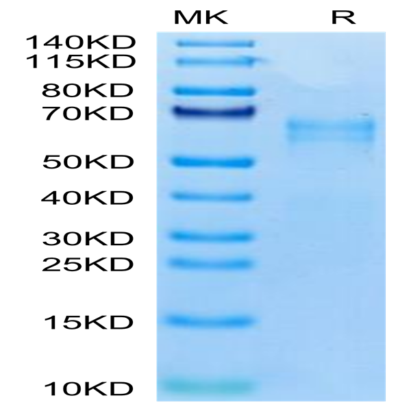 Human LTK Potein (LTK-HM101)