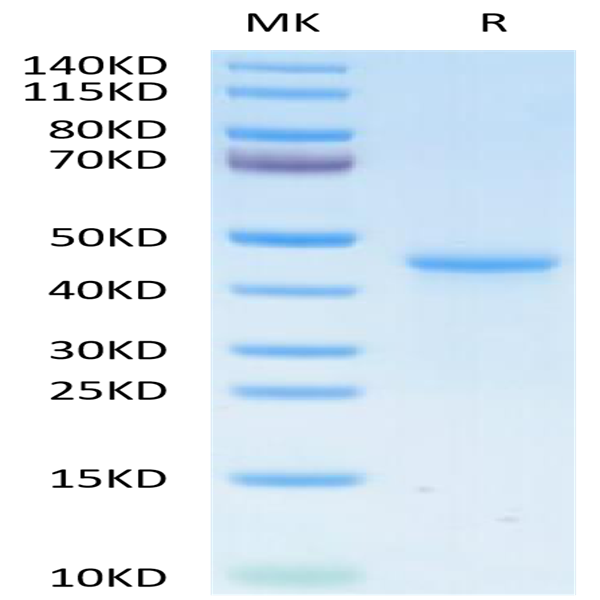 Human LY6G6D Protein (LYD-HM26D)