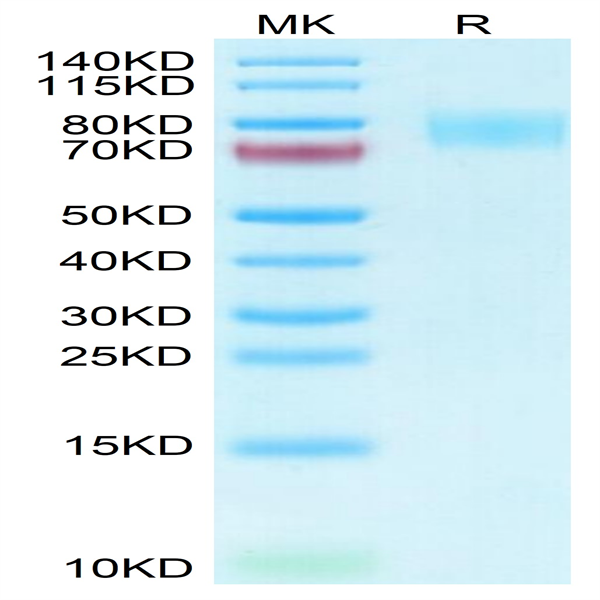 Human Siglec-4a/MAG Protein (MAG-HM101)