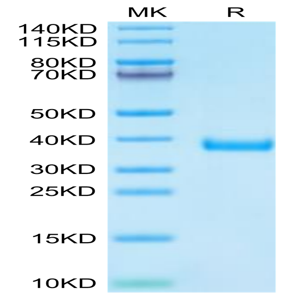 Cynomolgus MFAP4 Protein (MAP-CM104)