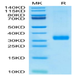 Human MBL2/Mannan Binding Lectin Protein BP003596 Syd Labs